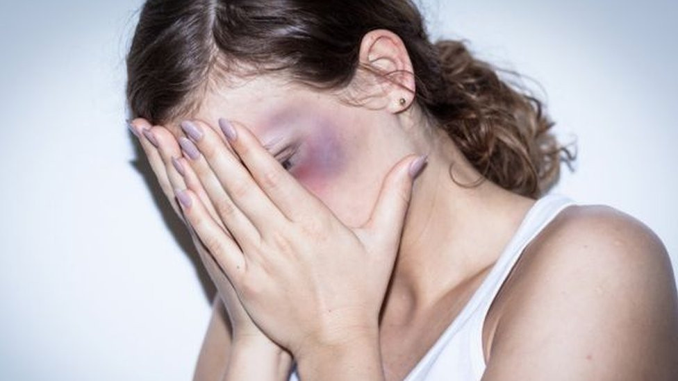 Žena pokriva lice rukama