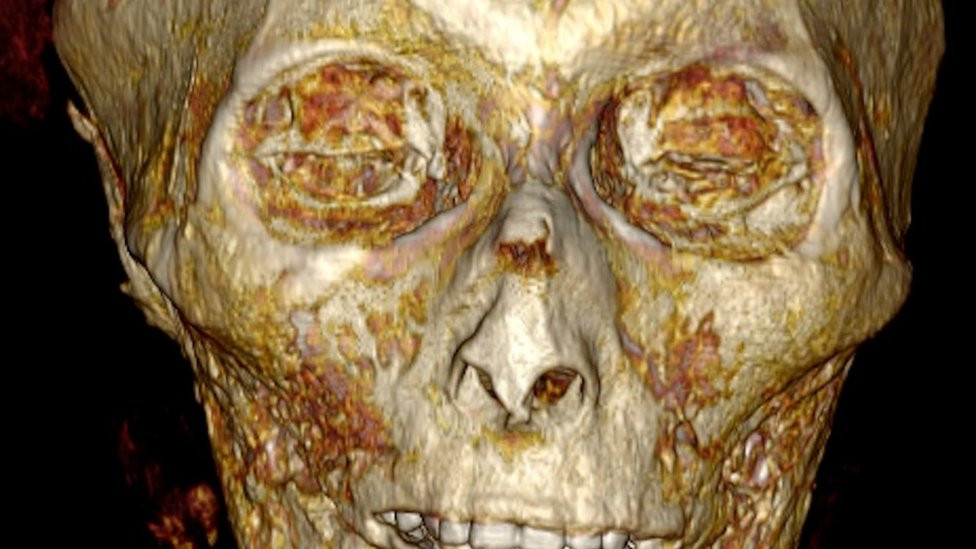 CT scan showing the skull of Amenhotep I