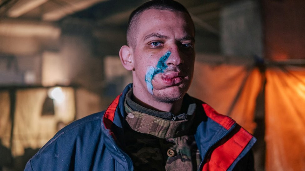 Wounded soldier inside the Azovstal steelworks