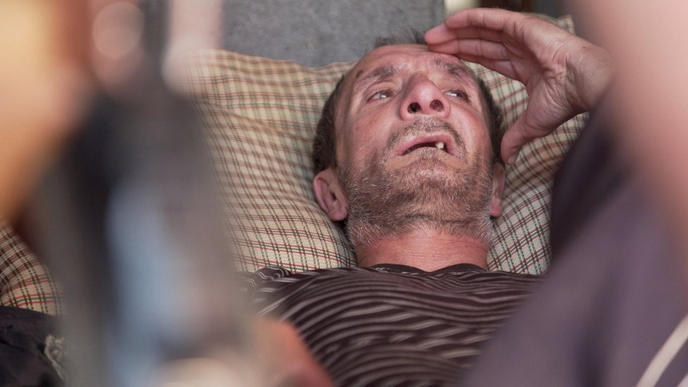 Saša leži nakon što je možda doživeo moždani udar