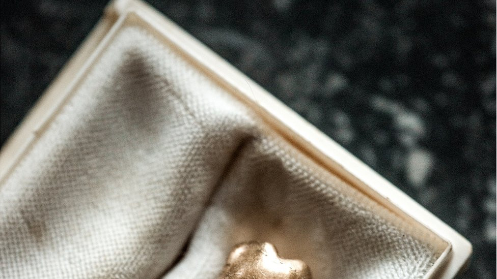 Picture of a tooth in a display box