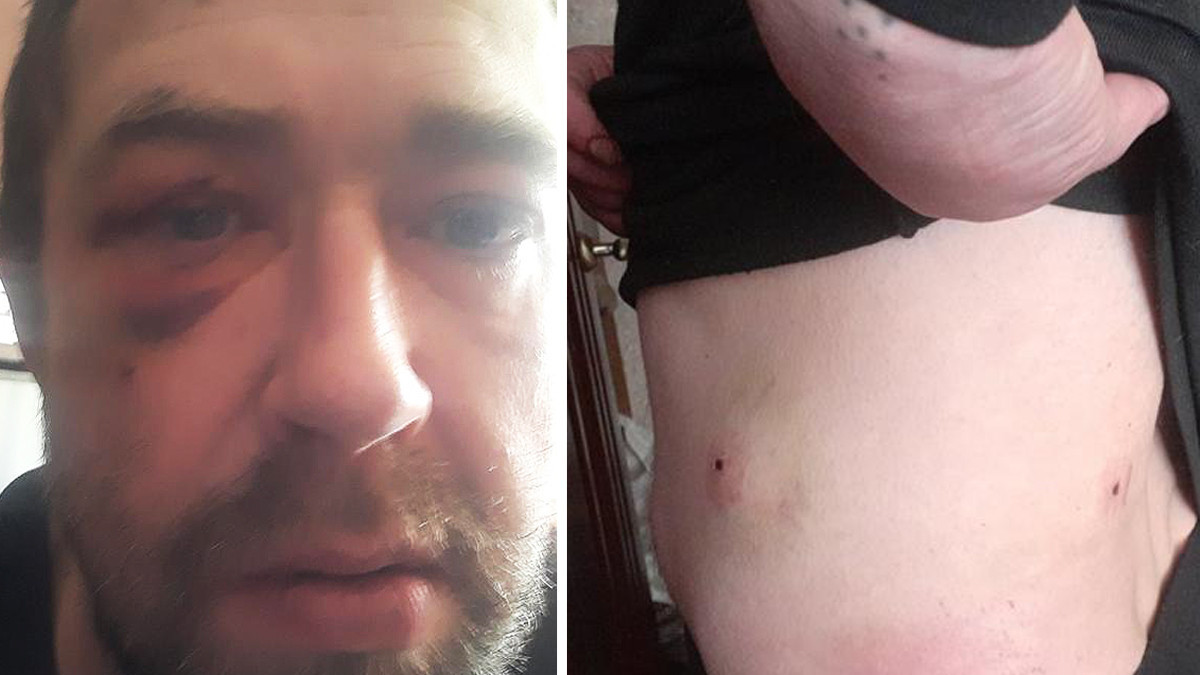 Otečeno lice Ivana Skibe i rane od metaka na torzu