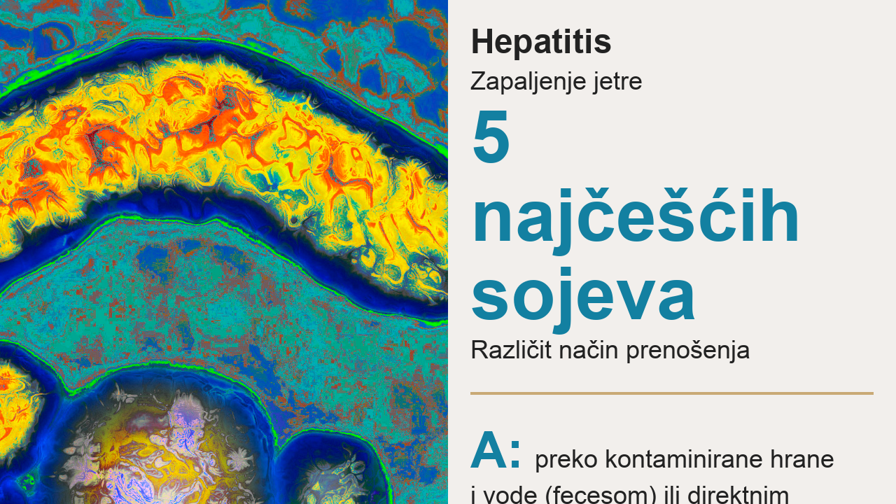 hepatitis