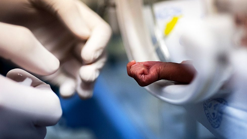 A child cared in the incubator