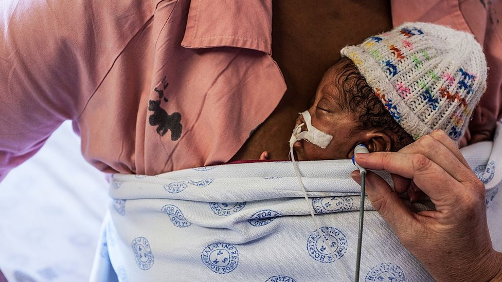 "kangaroo mother", holds her son against her skin while