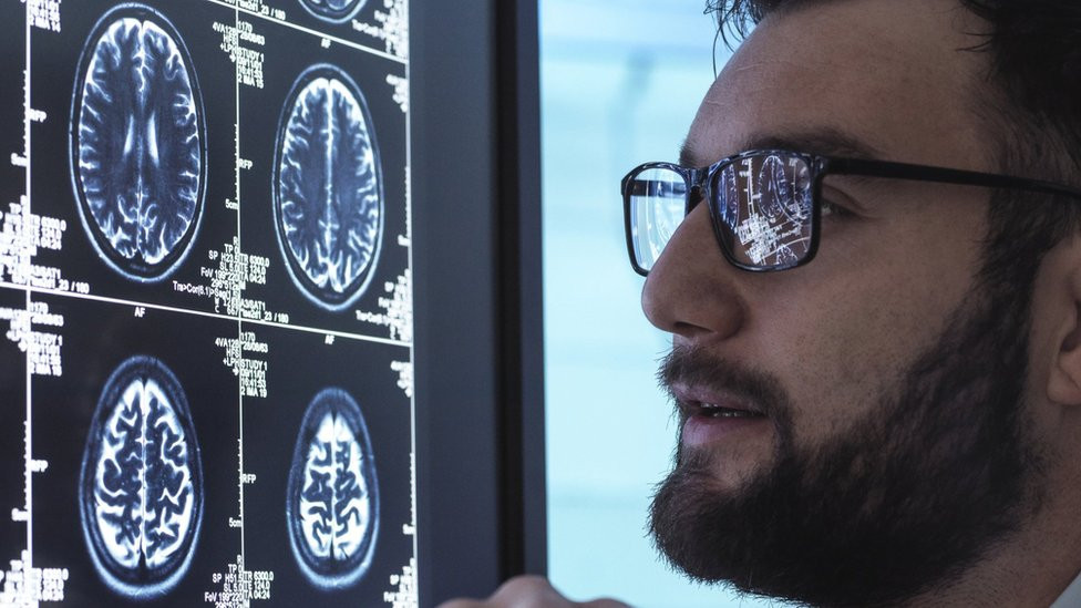 Doctor looks at brain scans
