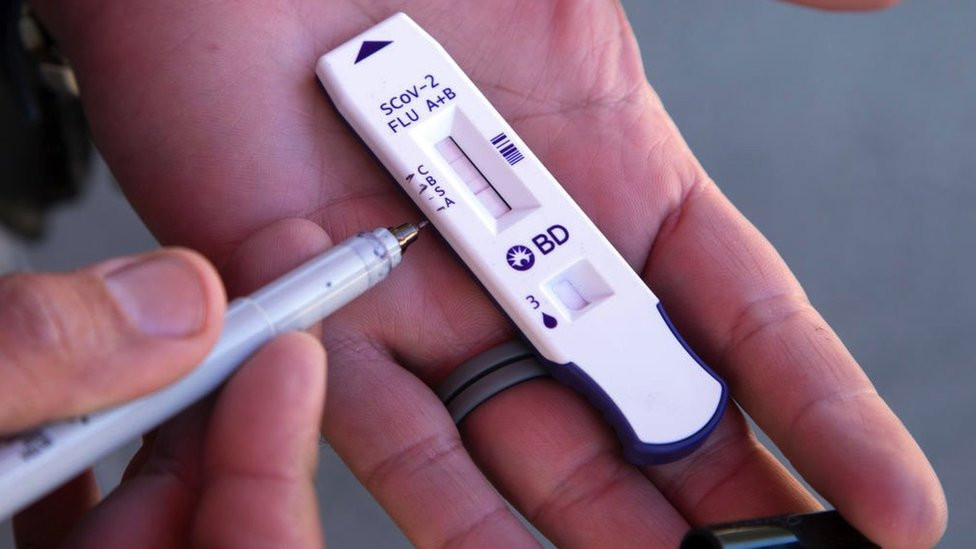 This antigen test cassette shows the control at top followed by flu B, SARS-CoV-2 and flu A