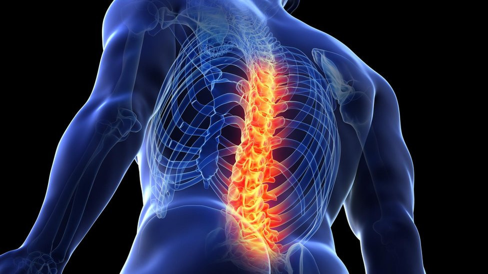 bol u leđima, leđa