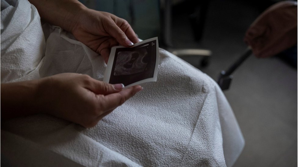 Žena gleda sliku sa ultrazvuka