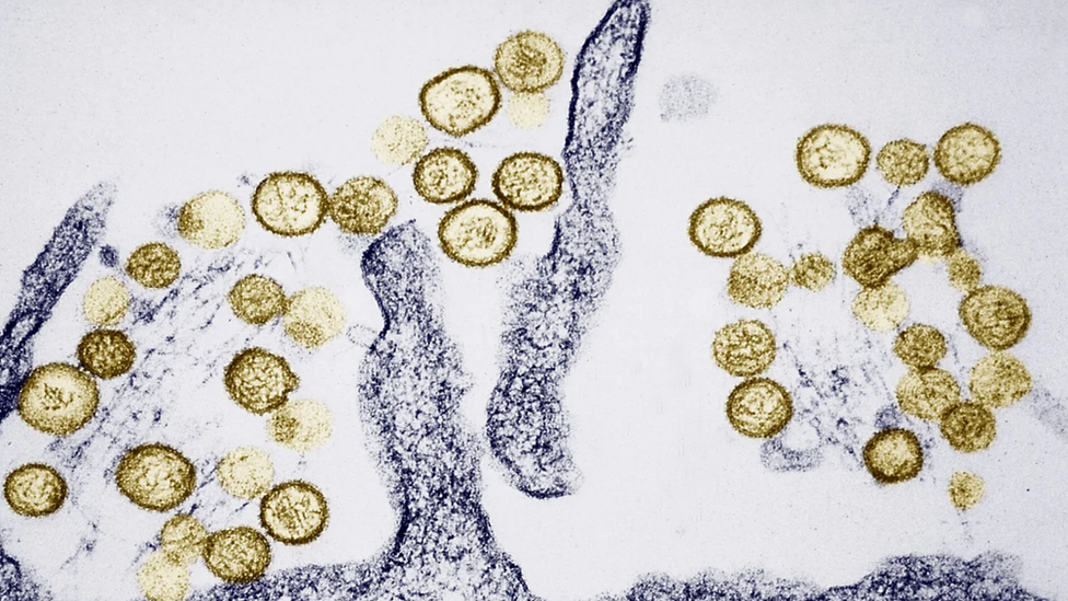 Outbreaks of the Sin Nombre hantavirus are now known to be linked to El Niño, which increases rainfall and boosts the population of its rodent hosts