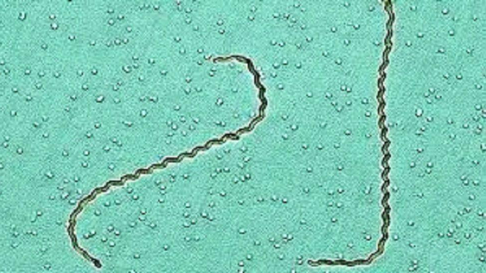 Leptospiroza je zoonoza uzrokovana spiralnim bakterijama iz roda Leptospira, koje obitavaju u bubrezima svojih prirodnih domaćina