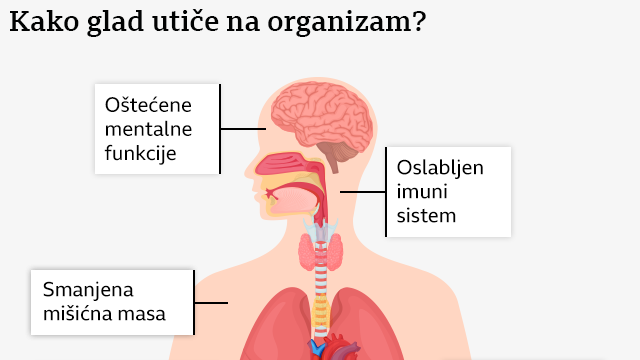 Ilustracija uticaja gladi na organizam