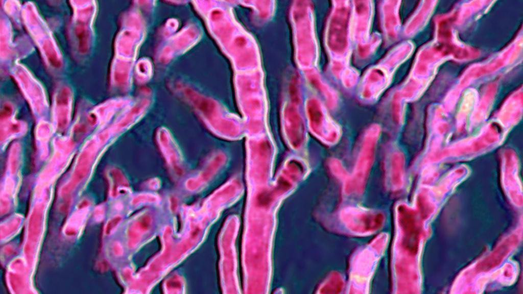 Aspergillus fumigatus  