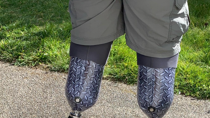 Snimak Nil Hoperovih protetskih nogu snimljen otpozadi. Nosi crno-bele patike.