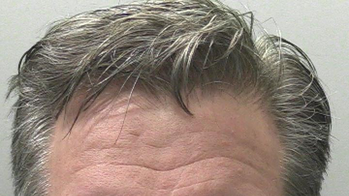 Fotografija Nila Hopera iz pritvora. Ima sedu kosu i gleda u kameru praznim izrazom lica.