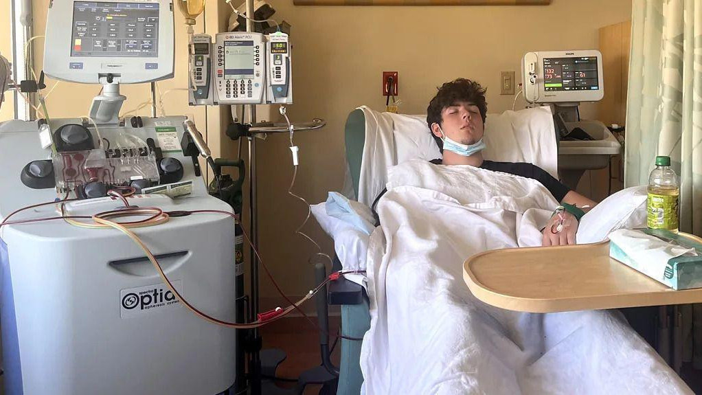 Dečak leži u bolničkom krevetu, priključen na aparate