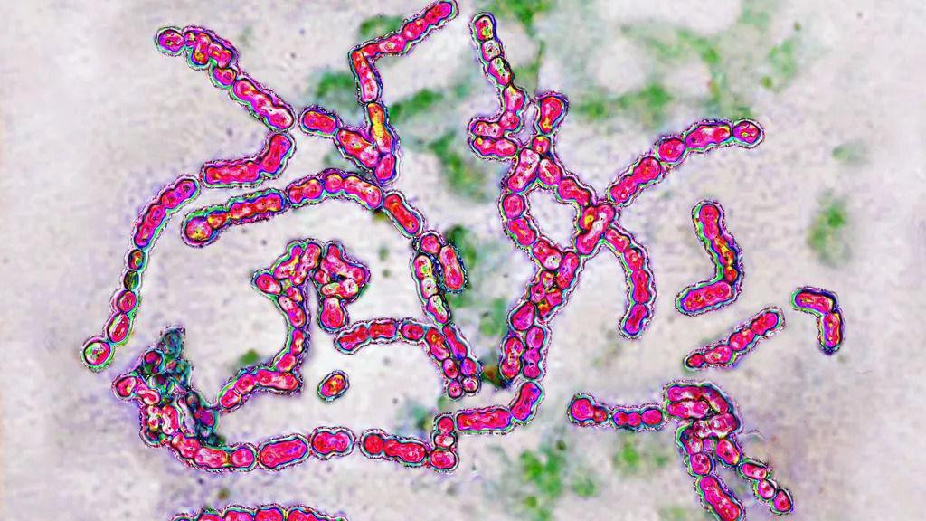 Mikroskopski prikaz bakterije streptokoke