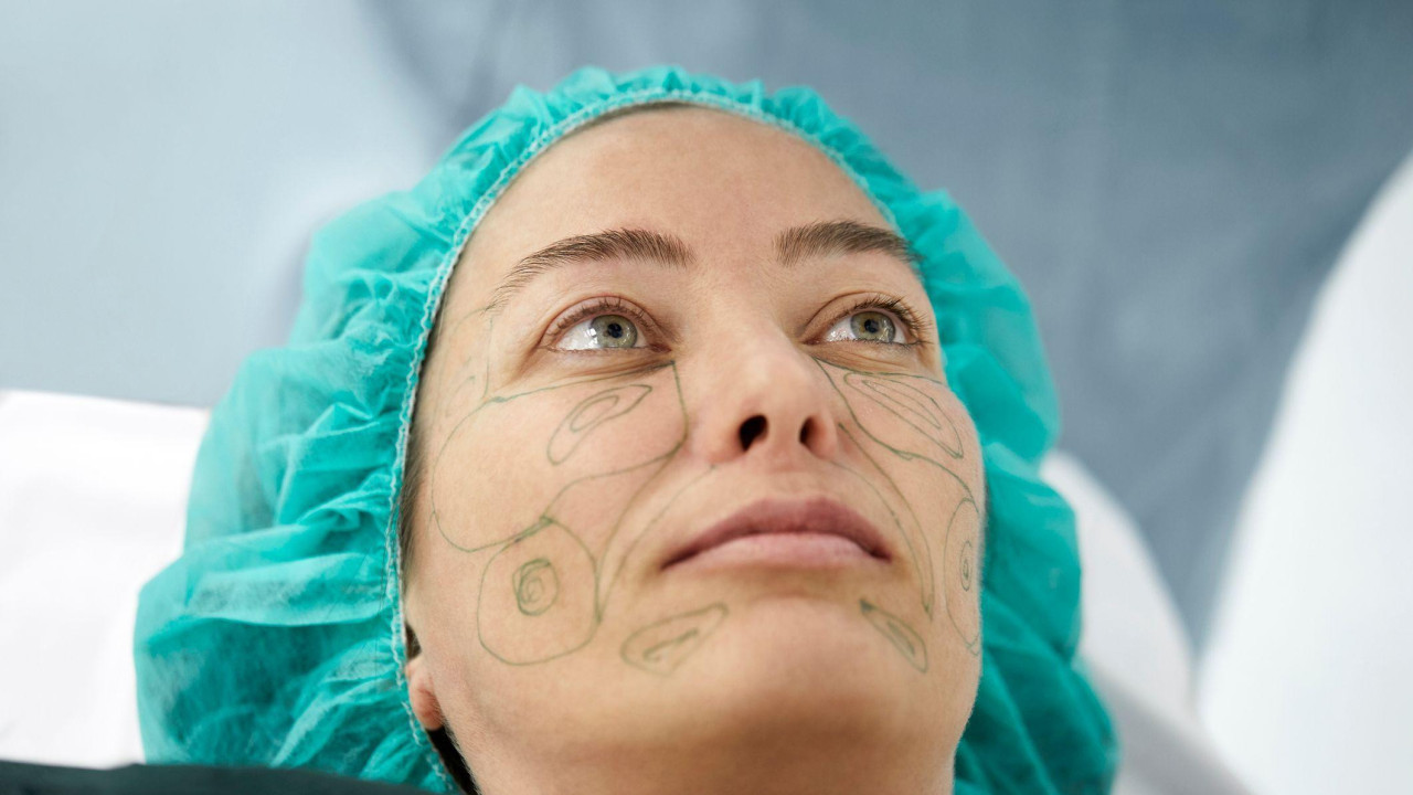 Tokom zatezanja lica prave se rezovi s obe strane lica, u blizini ušiju, koji se protežu do linije kose. Zatim se pravi rez na mišiću koji kontroliše izraze lica kako bi se tkivo i mišić mogli pravilno pozicionirati.