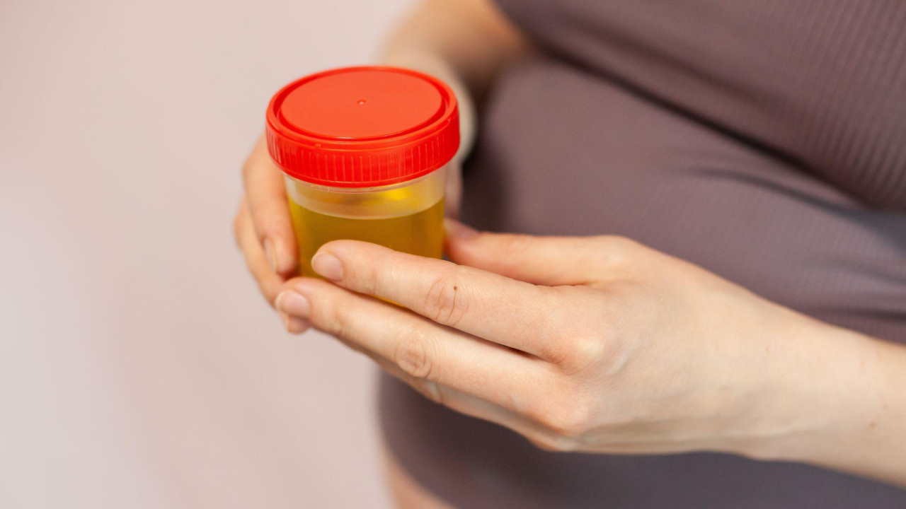 Lekar bi od vas mogao da zatraži da date uzorak mokraće na analizu u laboratoriju