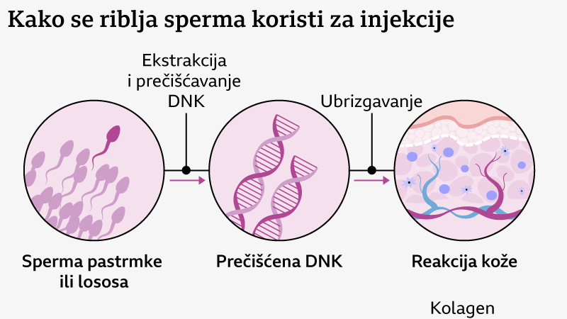 riblja sperma, injekcije od riblje sperme u lice