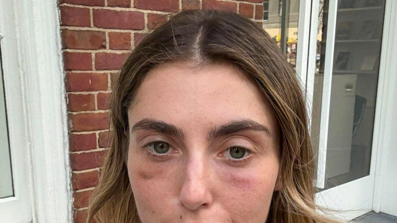 devojka u beloj majici na bretele gleda u kameru, ima tamne krugove oko očiju