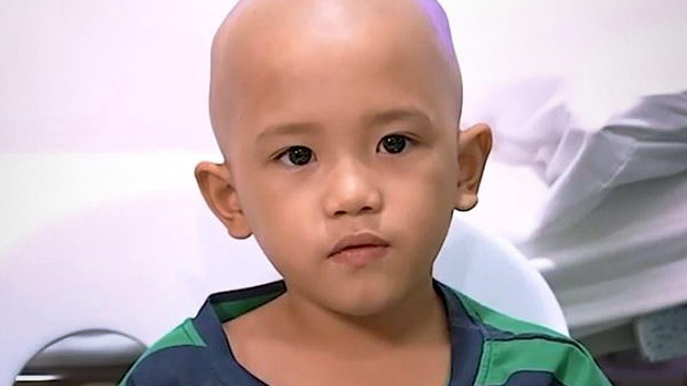 Halil, mali dečak sa Filipina, nosi majicu sa zelenim i plavim prugama, ima obrijenu glavu i mali mikrofon pričvršćen za majicu. Iza njega je beli bolnički zid. Gleda u kameru dok govori.