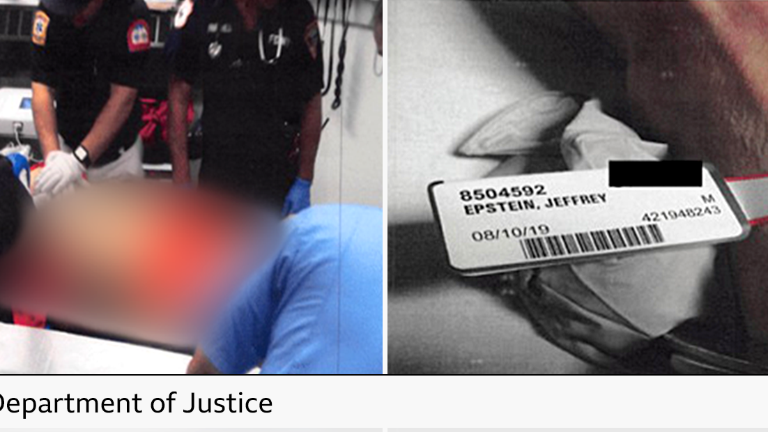 EMTs attend Epstein's body in left hand image, on the right Epstein's hand can be seen with a tag showing his name and date of death 