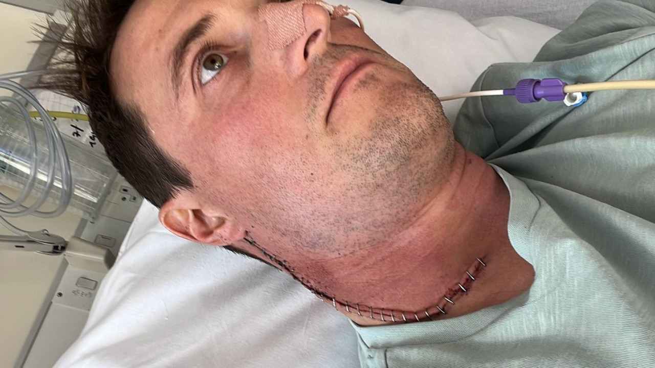 muškarac leži u bolničkom krevetu sa cevčicom u nosu, na vratu mu je veliki ožiljak od operacije