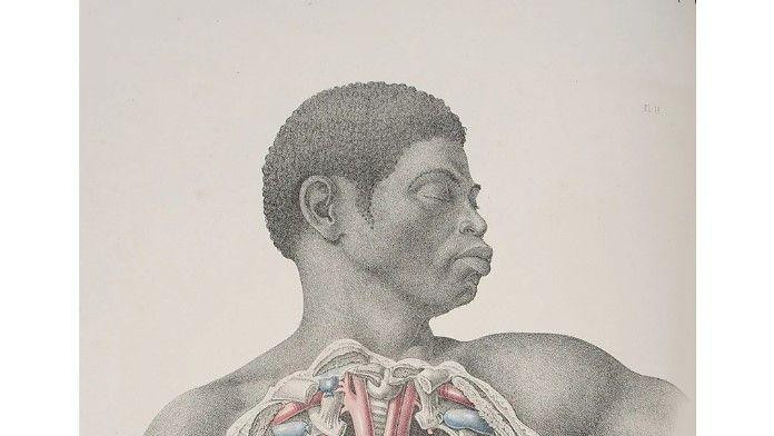 Minuciozni rad Maklisa uvršćen je u izložbu postavljenu u Tekerijevom muzeju medicine