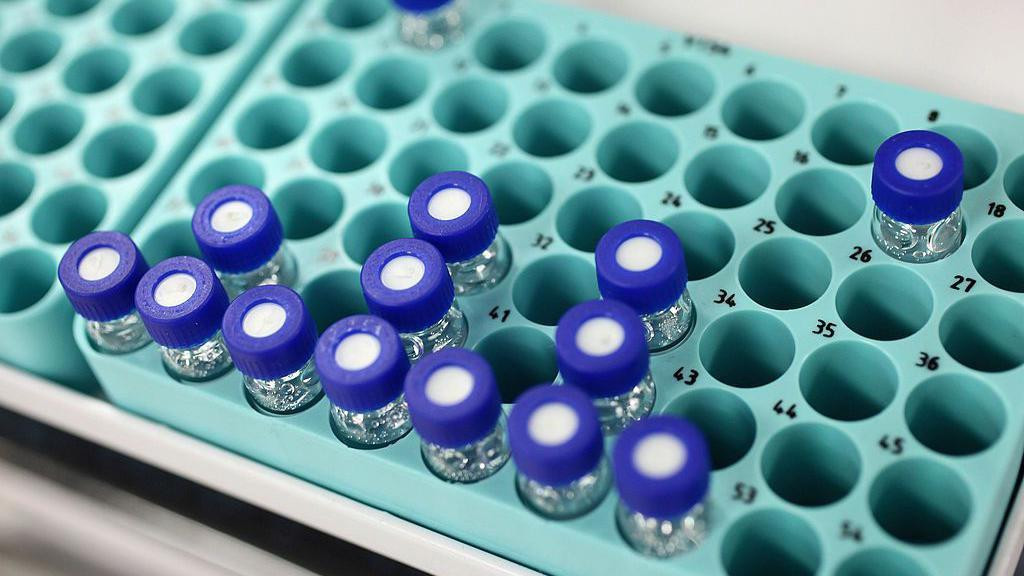 Laboratorijske epruvete