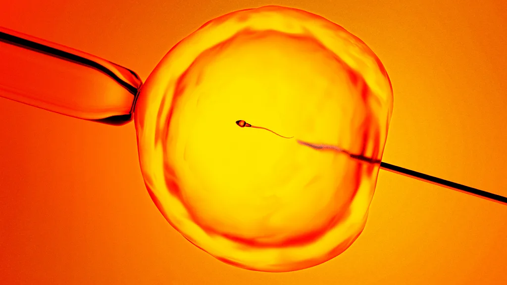 jajna ćelija u koju sa dve pipete ubacuju spermatozoid, viđena pod mikroskopom, na žuto narandžastoj podlozi