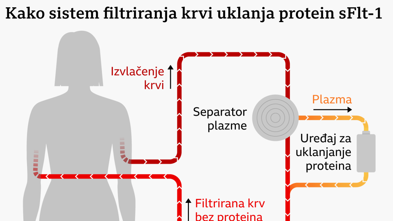 Grafika filtriranja krvi