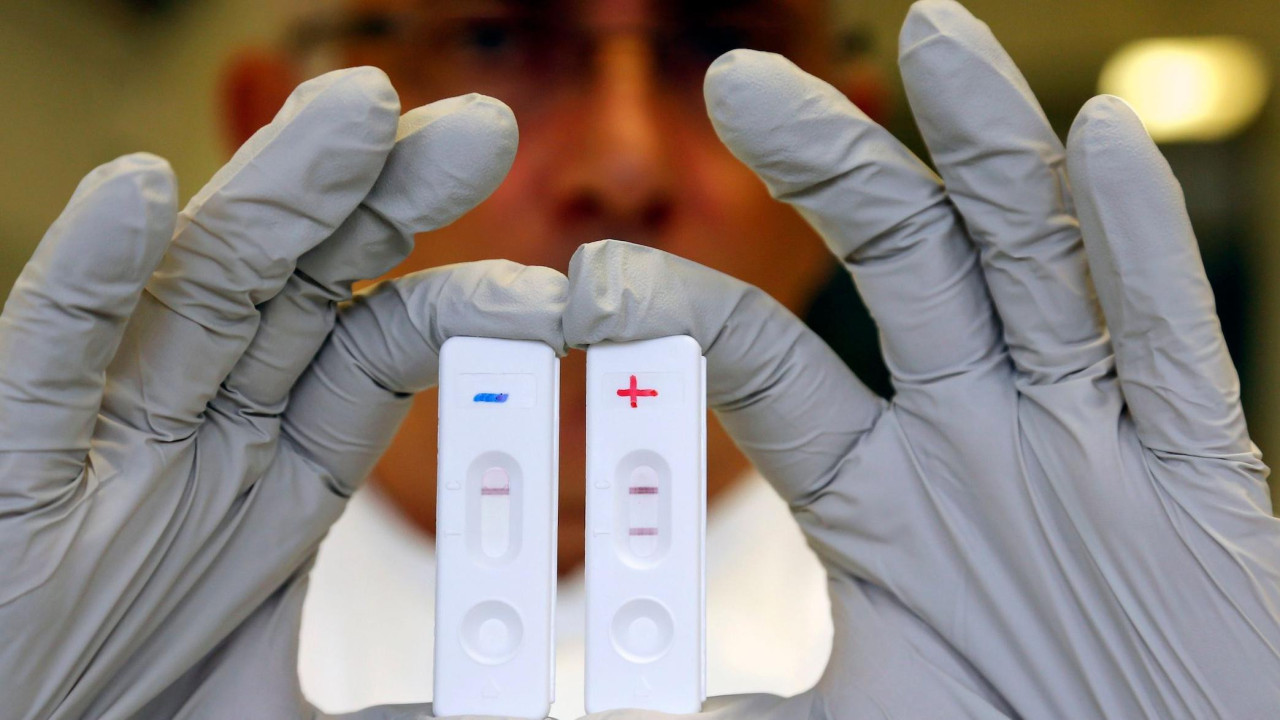 Test na ebola virus - arhivska fotografija