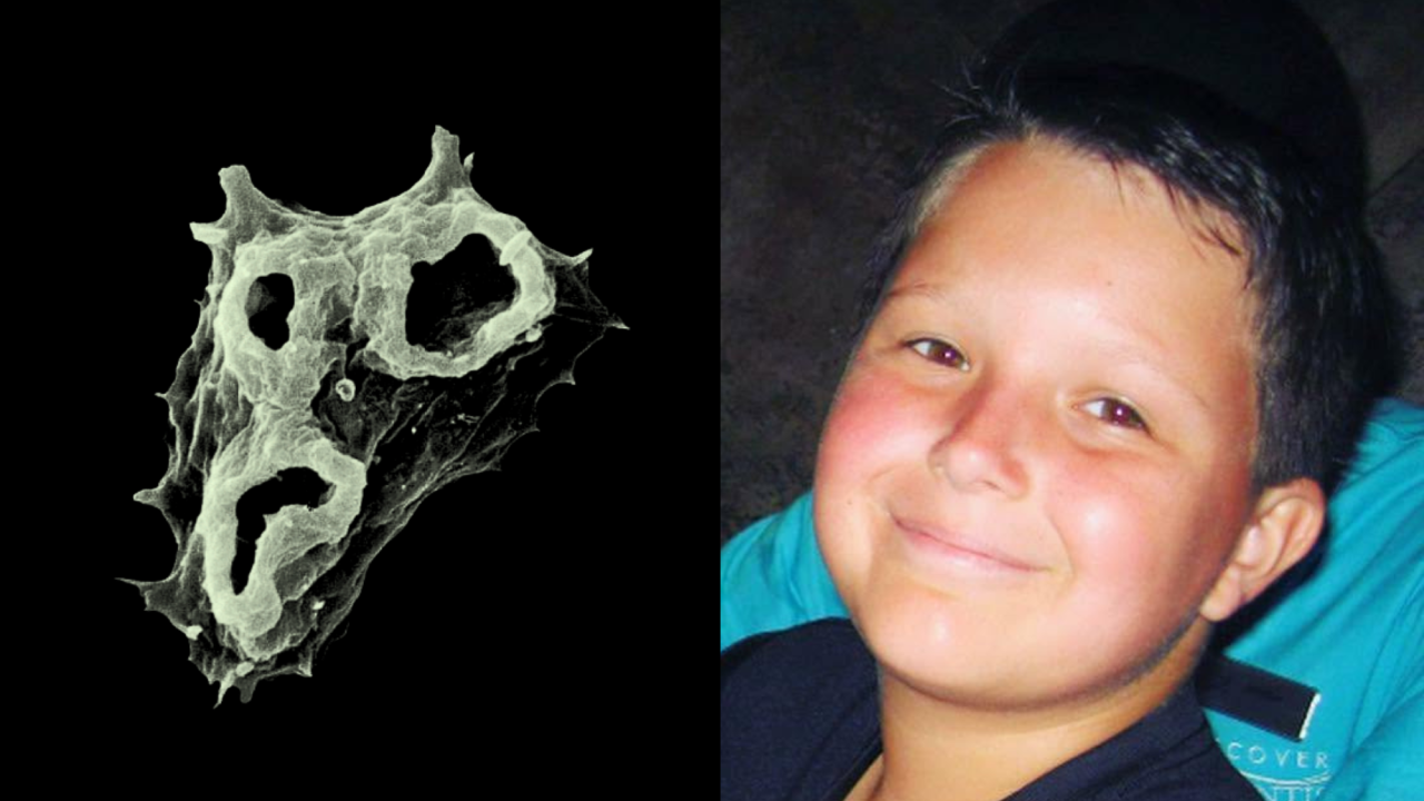 A magnified view of a Naegleria fowleri along with a picture of Jordan Smelski wearing a navy to 